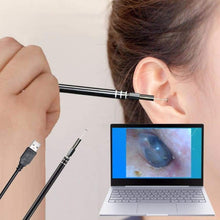 Charger l'image dans la galerie, kit De Nettoyage De Canal Oreille avec Caméra Endoscope - Livraison Gratuite - Oreille Soins
