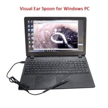 Charger l'image dans la galerie, kit De Nettoyage De Canal Oreille avec Caméra Endoscope - Livraison Gratuite - Oreille Soins
